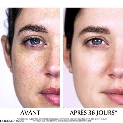 Eucerin Anti Pigment Sérum Duo 30ml
