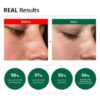 Dr.G - Red Blemish Clear Soothing Cream