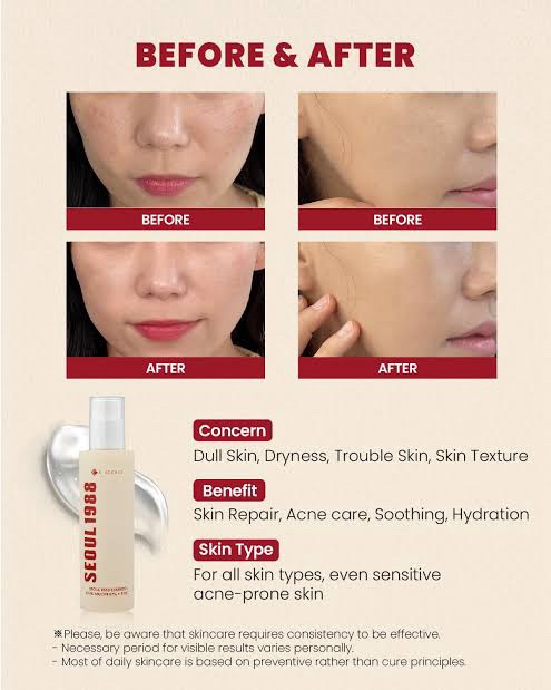 KSECRET - SEOUL 1988 Essence : Snail Mucin 97% + Rice - 100ml