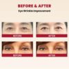 KSECRET SEOUL 1988 EYE CREAM : RETINAL LIPOSOME 4% + FERMENTED BEAN